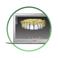 цифровое лечение зубов в стоматологии Сальве